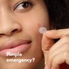 Hero Cosmetics The Original Hydrocolloid Patch - 36 Patches