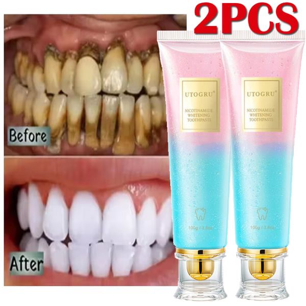 2PCS Niacinamide Whitening Toothpaste Niacinamide Intensive Whitening Toothpaste
