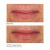 NassifMD Lip Sugar Scrub - Pink Champagne