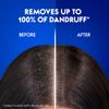 Head & Shoulders Anti-Dandruff Shampoo - Apple Fresh 13.5oz (400ml)