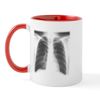 CafePress Radiological Mug 11 oz (325 ml) Ceramic Coffee Mug