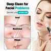2pcs Replaceable Metal Head for Blackhead Remover, Supports WiFi Blackhead Removal