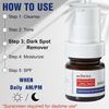 Aobenz Dark Spot Remover Serum (1.35 oz) - NEW