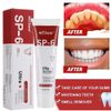 SP-6 Super Probiotic SP-6 Toothpaste, Probiotics Bright White Toothpaste, Sp 6