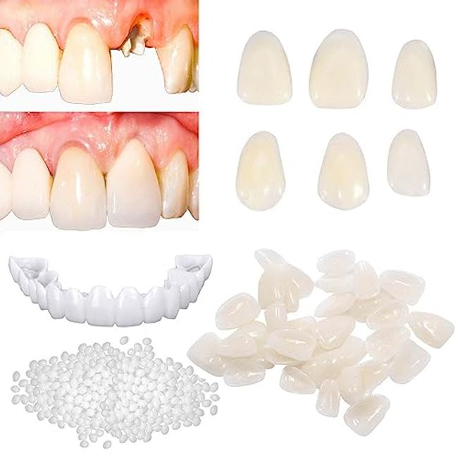 Tooth Repair Kit, Moldable Dental Care Kit for Fixing The Mi