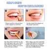 Aligner Chewies, 12-Pack Medical Grade Silicone Orthodontic Chompers Aligner Trays Seaters Chewies for Invisalign Aligners(Green)