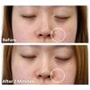 Dermaflage Scar Filler Refill, 4 Applicators