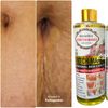 Ascorbic stretch-mark Oil,Body Oil For Scars & Stretch marks,oil Hydrates,Fades