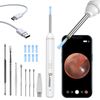 Ear Wax Removal Kit: 1920P HD Camera & 8-Pc Ear Set for iPhone, iPad & Android