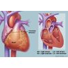 antioxidant complex - BEET ROOT - critical supporter digestion 2 Bottles