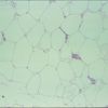 Human Adipose Tissue Slide, 7 M, H&E