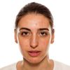 Le Pore Serum (Acne Serum, Pore Serum)