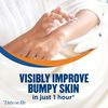 Gold Bond Rough & Bumpy Daily Skin Therapy, 8 Ounce by Gold Bond