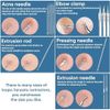 Blackhead Remover Pimple Popper Tool Kit, Blackhead Extractor Tool,11PCS