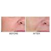 Absolute Pores Tightening Serum Mini