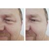 VIP Precise Instant Eye Lift Miracle Cream