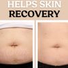 StriaeSolution Serum 8 oz.