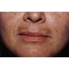 Bio Fair Anti-Blotching & Brightening Face Cream | 50ml
