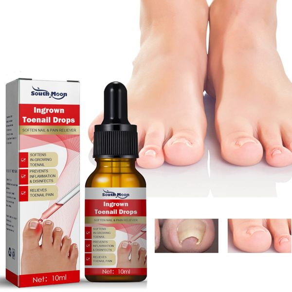 Ingrown Toenail Treatment,Nail Helper,Nail Growth Treatment,Ingrown Toenail Drops,Cuticle Nail Oil,Ingrown Toenail Correction,Fungal Nail Treatment for Toenails, Extra Strong for Damaged Nails