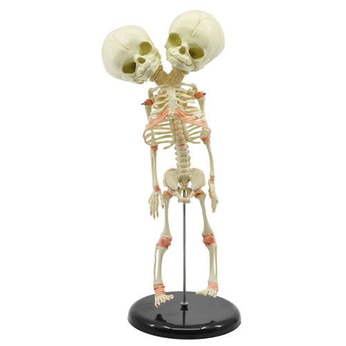 EISCO Infant Fetus Skeleton Model, Mini Size - Twin, Conjoined Skull - Rod Mounted - Incredible Detail for Anatomical Study - Eisco Labs
