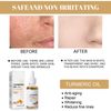 Turmeric Dark Spot Corrector 2 Pack Serum Face Serum Bright Skin Dark Spot Corrector Face Whitening Serum Turmeric Repair Face Body Serum for Dark Spots Skin Lightening Moisturizing (2PCS)