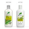 Organic Doctor Organic Tea Tree Conditioner, 9 fl.oz.