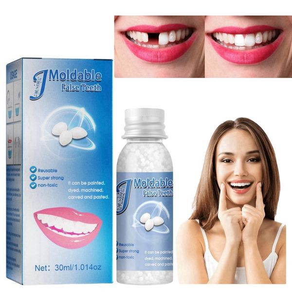 Temporary Tooth Filling,Repair Beads Tooth Repair Kit ,Moldable False Teeth,Tooth Filling Repair Kit,Filling Kit For Teeth,DIY Tooth Repair Granules,Dental Repair Kit Filling,Broken Tooth Repair