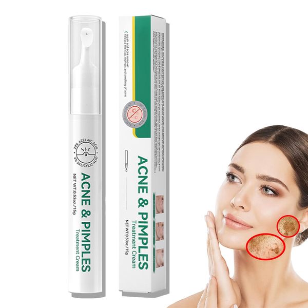 Anti Acne Face Cream & Dark Spot Remover for Face丨Acne Cream丨Spot Cream For Acne & Spot 丨Anti Acne Spot For Face, Back, Inner Thigh Butt丨Blackhead Remover Cream for Face & Back Acne Anti-Blemish Care