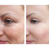 Vitality Precision Skin Phloretin C Serum