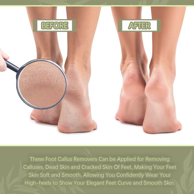 Foot File Feet Rasp Callus Remover Pedicure Hard Dead Skin Double Sided Tool