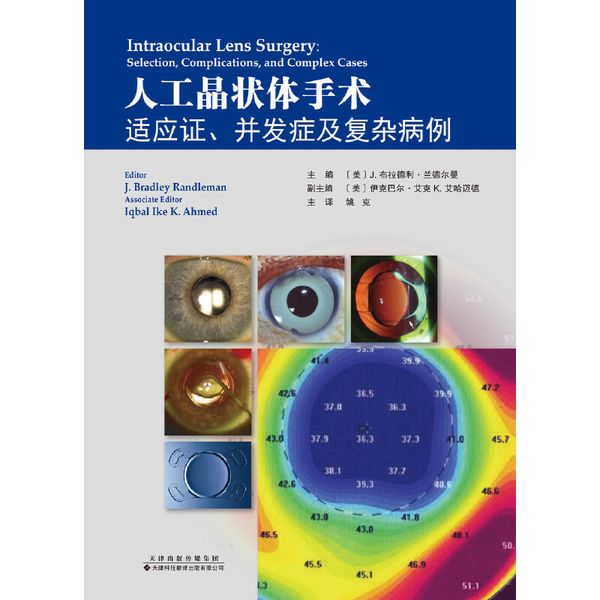 《人工晶状体手术：适应证、并发症及复杂病例》