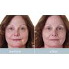 Skinbunny Facial Contouring System