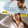 100pcs Anti Perspirant Pads Disposable Antiperspirant Patches For Armpits Anti Hyperhidrosis For Men Women Summer Armpit Protector Patch Traces of Sweat Underarms