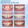 2PCS Tooth Repair Granules Temporary Reusable Moldable False Teeth Fitting Beads