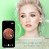 Ear Wax Removal Kit: 1920P HD Camera & 8-Pc Ear Set for iPhone, iPad & Android