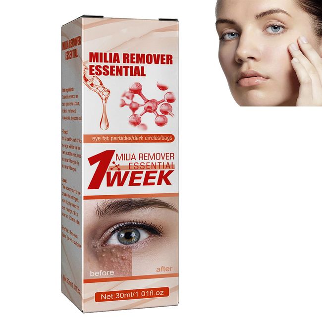 Schnelle Milienentferner,Milia Remover Essential,Verblassen Sie Feine Linien,Augenessenz mit feiner Linie verblassen,Milia Spot Behandlung für Auge,Heben und Straffen Sie die Augenessenz