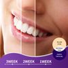 AZ Smile Purple Colour Corrector Serum Teeth Whitening Toothpaste Kit 30ML