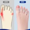 Toe Spread Bunion Correction Goods, Pack of 2, Bunion Supporter, Stretchable, Unisex