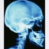 CafePress Skull X Ray Mousepad Non-slip Rubber Gaming Mousepad