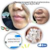 MT Dark Lip Solution 5g ( គ្រីមព្យាបាលបប