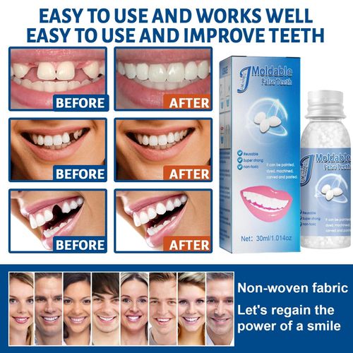 Temporary Tooth Filling,Repair Beads Tooth Filling Repair Kit,False Teeth,Moldable Tooth Repair Kit,Thermal Forming Filling Kit for Teeth,Tooth Repair Granules,DIY Fixing Dental Bridge Repair Kit