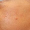 Hydration Refinement Facial Scrub -  Youmans Touch Wellness