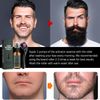 Beard Growth Set with Titanium Derma Roller, Beard Roller Kit 30 ml, Beard Roller Beard Growth Serum Oil, Beard Growth Roller, Beard Microneedle, Beard Care Set Best Gift for Men