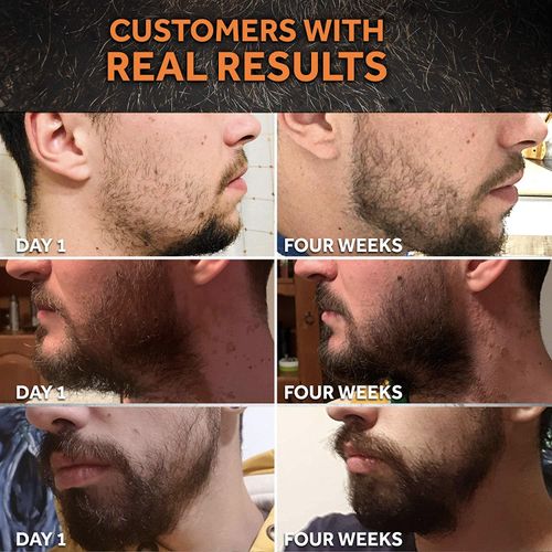 Beard Growth Oil - 1Fl Oz - Growing Serum That Softens & Strengthens Beards and Mustaches - Facial Hair Treatment Treatment Infused with Biotin Capilia Longa Niacinamide and 100% Natural Ingredients