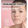 WUNDERTAPE Acne Patches, Anti-Pimple Patch (Pack of 80)