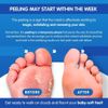 Pedicure Grade Foot Masks That Remove Dead Skin | Smooth and Soften Foot Peel mask for Dry Cracked feet Premium | Imperial Feet