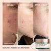 Biossance Squalane + Probiotic Balancing Gel Moisturizer 1.69 oz / 50 mL