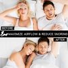 AIRMAX Nasal Dilator for Better Sleep - Natural, Comfortable, Anti Snoring Device, Snoring Solution for Maximum Airflow and Easier Breathing (Medium - Clear)
