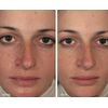 (1) I IMAGE ORMEDIC Balancing Gel MASQUE MASK PRO 12oz/355ml New $240 ‼️READ +🎁