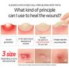 1+1 Elizavecca Acne Cover blemish Spot Patch Hydrocolloid Patches 44+44 = 88 Count (12mm 12 Count, 10mm 8 Count, 8mm 24 Count x 2) / spot patches, Vegan-friendly, Not Tested on Animals, Acne Pimple Patch for Covering Zits and Blemishes, Spot Stickers for 